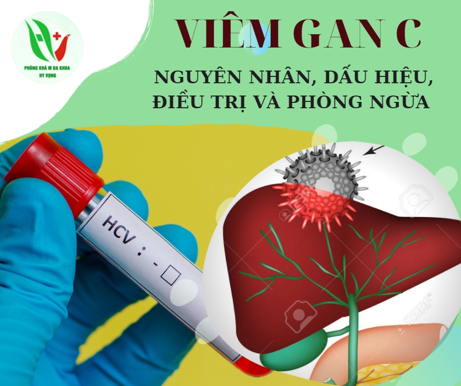 VIÊM GAN C: NGUYÊN NHÂN, DẤU HIỆU, ĐIỀU TRỊ VÀ PHÒNG NGỪA